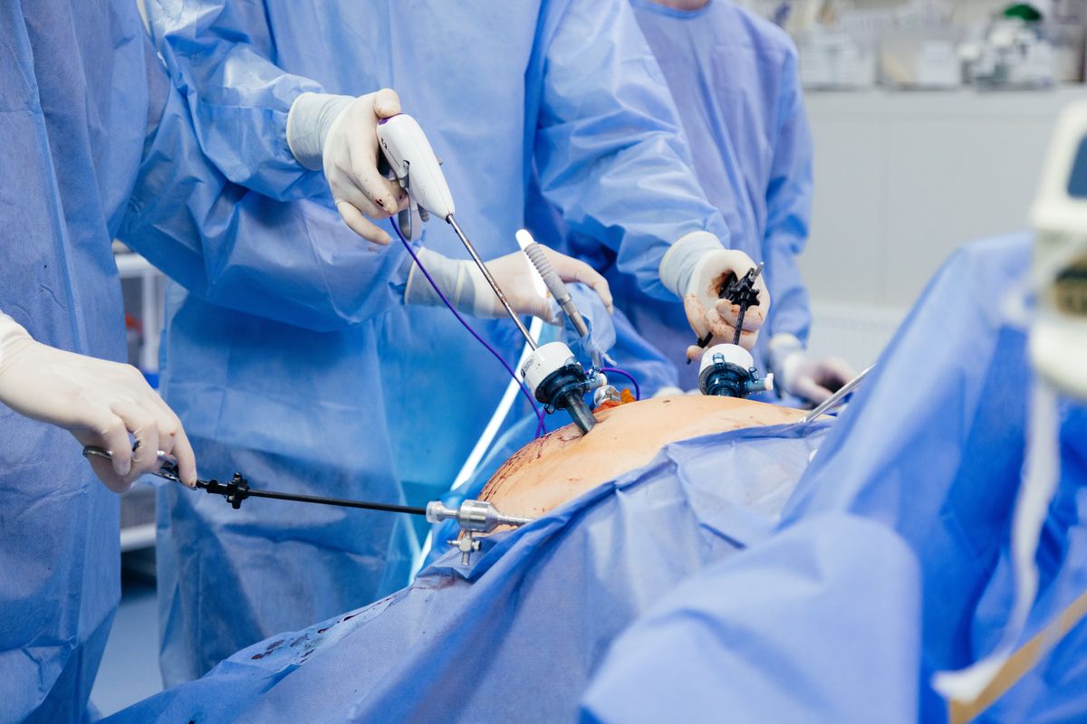 Laparoscopic keyhole surgery
